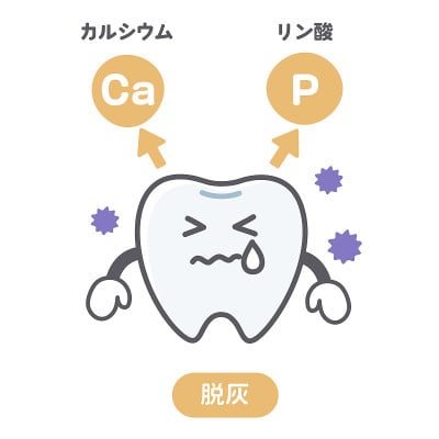 牙齿脱钙和再矿化的图示