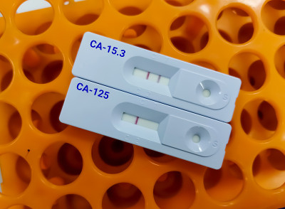 分离CA-15.3和CA-125快速检测盒，CA-15.3阳性