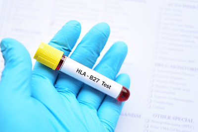 用于HLA-B27检测的血样管