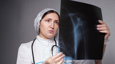 女骨科医生在诊所看x光片