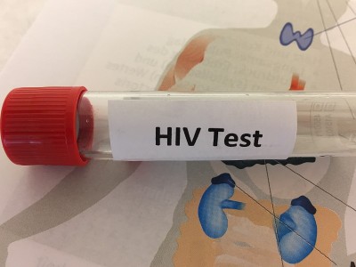 HIV实验室检测用试管