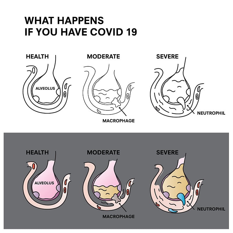 Coronavirus 2019-nCoV Infographic, What happens if