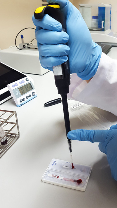 在大学研究实验室工作的手戴蓝手套的科学家或实验室技术人员，在科学室医院进行血液快速检测，将血样滴在平