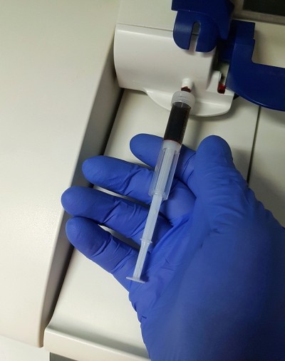 实验室的血液分析