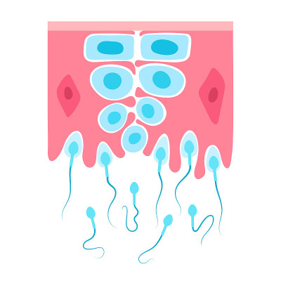 Spermatogenesis