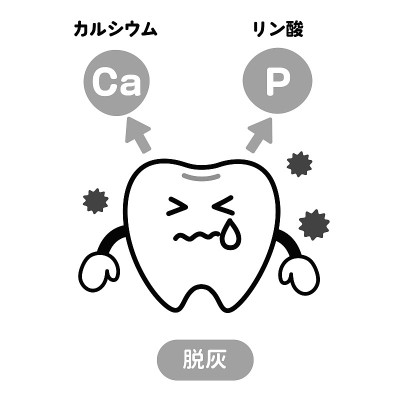 牙齿脱钙和再矿化的图示