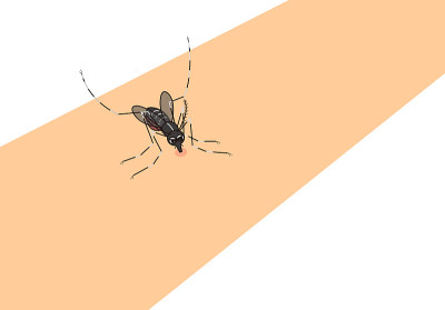 蚊子