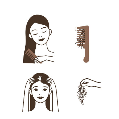 脱发