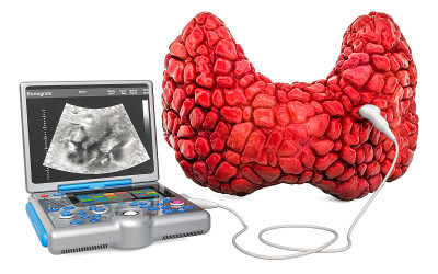 甲状腺超声的概念。人体甲状腺用医用超声诊断仪，在白色背景上3D渲染孤立
