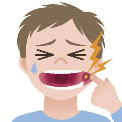 口腔炎，口腔溃疡，口腔黏膜炎症，图像说明