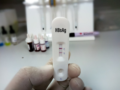 科学家或技术人员手持显示乙肝病毒阳性结果的快速检测盒。近距离观察与实验室背景。