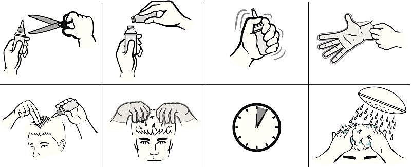 个别男性和头皮屑头发治疗染料