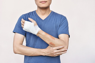 事故后手缠着绷带的男人