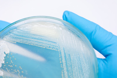 培养皿酵母菌，实验室微生物学教育。