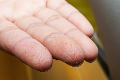刺在手指