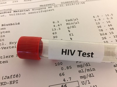 HIV实验室检测用试管