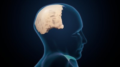 人类骨骼头骨顶骨解剖。3d插图