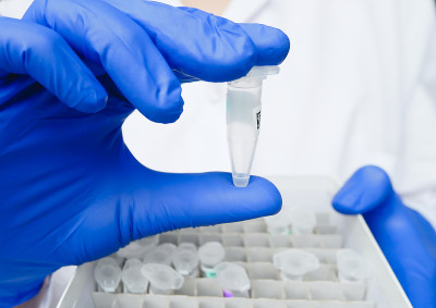 科学家的手拿着装有病人DNA样本的试管。基因实验室研究人员拿着样品箱。基因和癌症筛查、医疗技术和治疗