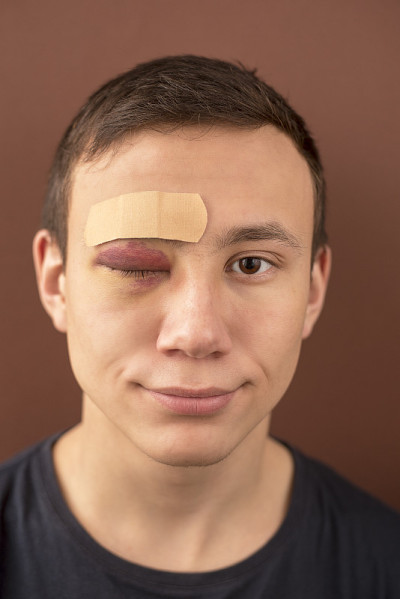 一个年轻的男人，一只眼睛打了个黑眼圈，眉毛上还贴着创可贴