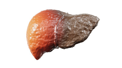 肝硬化的概念。白色背景下分离的肝脏。剪切部分。3 d渲染。
