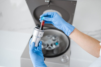 美容师医生的手将装有血液的试管放入离心容器中。复兴plasmolifting过程
