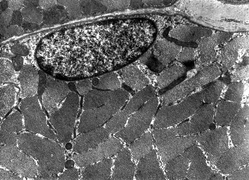 横纹肌细胞。TEM显微照片