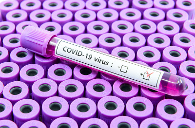 2019冠状病毒病(COVID-19)阳性患者的血液样本放在样管上