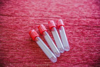 关闭凝血管。