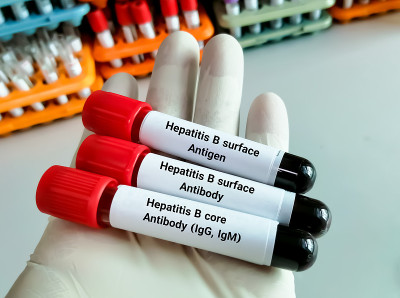 科学家保存了用于HBsAg、HBsAb和HBc (IgG, IgM)检测的血液样本。乙型肝炎抗原及抗