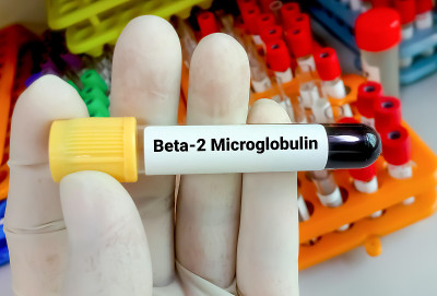 科学家保存了β 2微球蛋白的血液样本