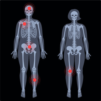 Pain4_Skeleton