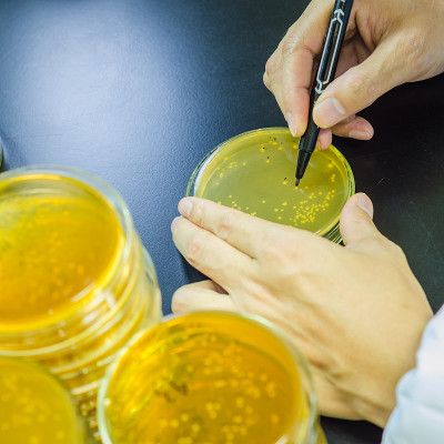 琼脂板上满是微生物和微生物