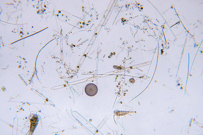 显微镜下的海洋水生浮游生物