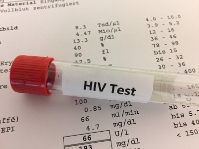 HIV实验室检测用试管