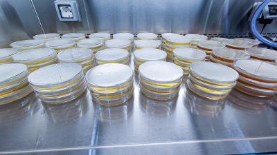 在微生物实验室进行培养皿菌落检测。