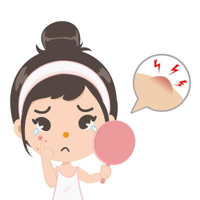 这位女士担心她的粉刺。