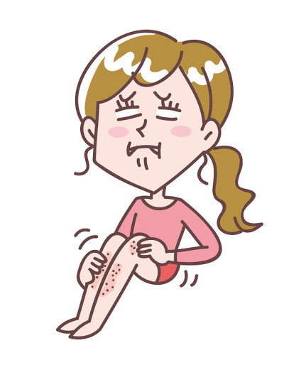 腿发痒的女人