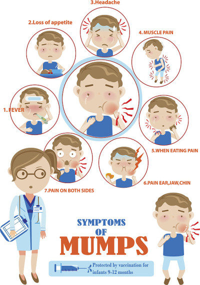 流行性腮腺炎