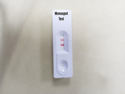 快速检测单核细胞斑点或单核细胞增多斑点试验，结果呈阳性