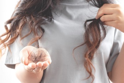 女性对洗发水过敏会导致脱发和头皮屑。