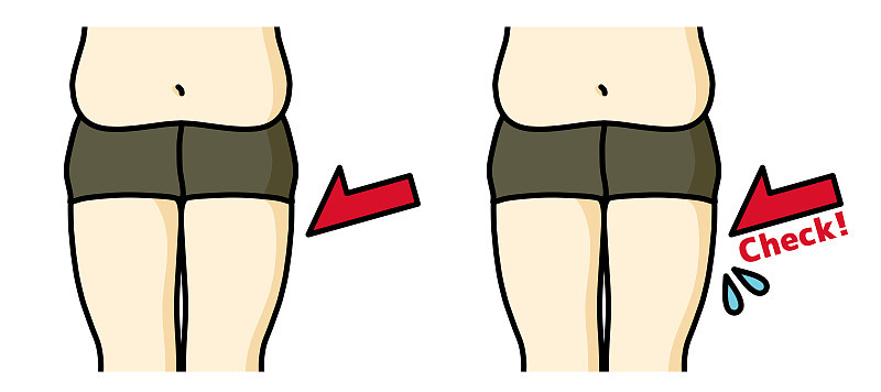 胖女人thighs-check