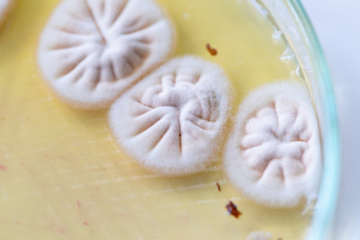 放线菌、细菌、酵母菌和霉菌在土壤样品选择培养基上的菌落特性。