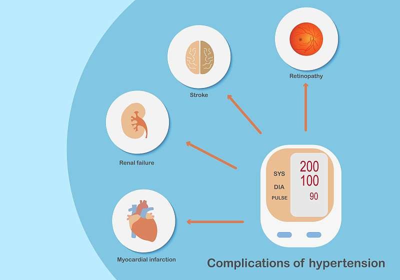 高血压并发症影响器官。