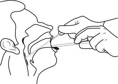 将棉签插入口腔导管