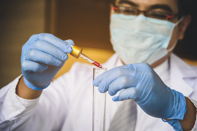 医生正在用血样做实验来预防和治疗传染病。