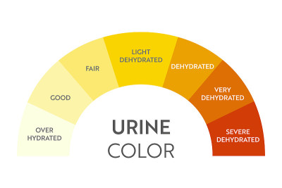 urine_color