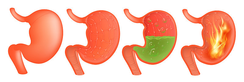 Vector Medical illustration of realistic stomach o