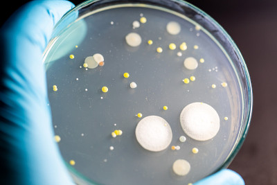 微生物实验室教育用土壤样品中细菌和霉菌在琼脂平板上生长的特点和不同形状菌落的背景。