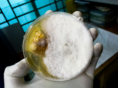 这位科学家正手持培养皿，用麦芽提取物琼脂作为生长介质，以分离和培养酵母、霉菌、青霉菌测试，在医疗卫生
