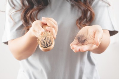 女性对洗发水过敏会导致脱发和头皮屑。
